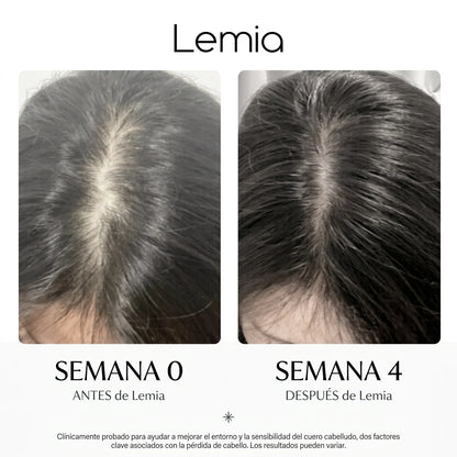 Sérum PDRN Coreano: Directo a la Raíz - Anticaída y Reactivación capilar