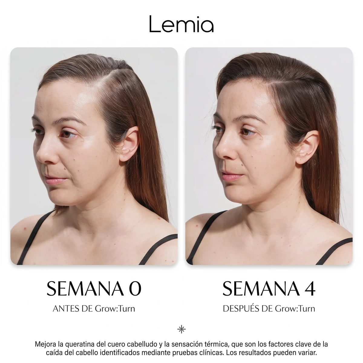 Sérum PDRN Coreano: Directo a la Raíz - Anticaída y Reactivación capilar