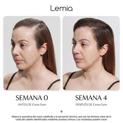 Sérum PDRN Coreano: Directo a la Raíz - Anticaída y Reactivación capilar