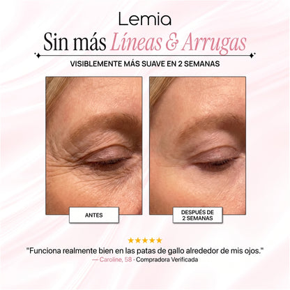 Cinta de Colágeno — Tu Alternativa al Bótox Sin Agujas.