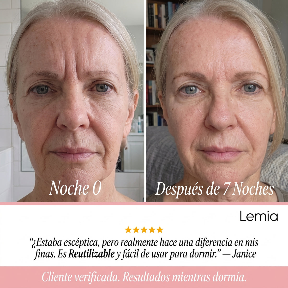 Cinta de Colágeno — Tu Alternativa al Bótox Sin Agujas.